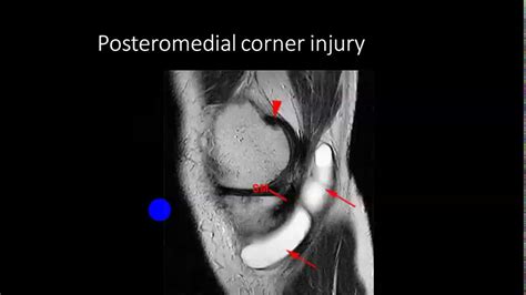 soft tissue injury imaging